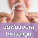 invisalign
