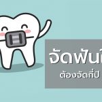 จัดฟันแบบใส-Invisalign