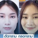 ตัดกราม