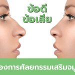 ศัลยกรรมเสริมจมูก